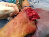 contusion1.JPG (289680 bytes)